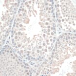 Immunohistochemistry - Anti-Thioredoxin / TRX Antibody (A91578) - Antibodies.com