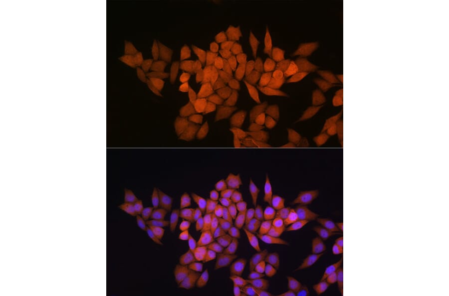 Immunofluorescence - Anti-Thioredoxin / TRX Antibody (A91578) - Antibodies.com