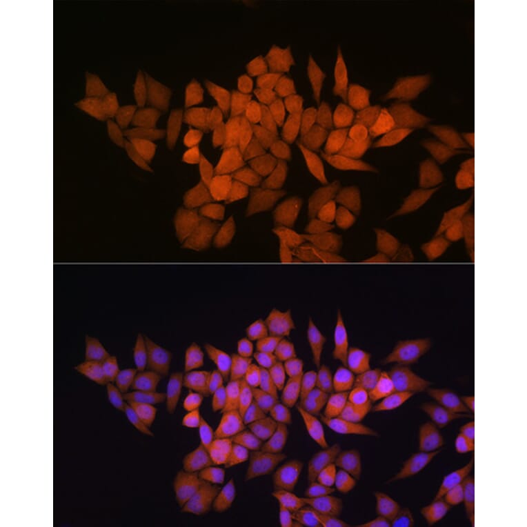 Immunofluorescence - Anti-Thioredoxin / TRX Antibody (A91578) - Antibodies.com