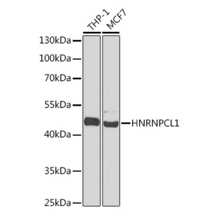 Western Blot - Anti-HNRNPCL1 Antibody (A91580) - Antibodies.com