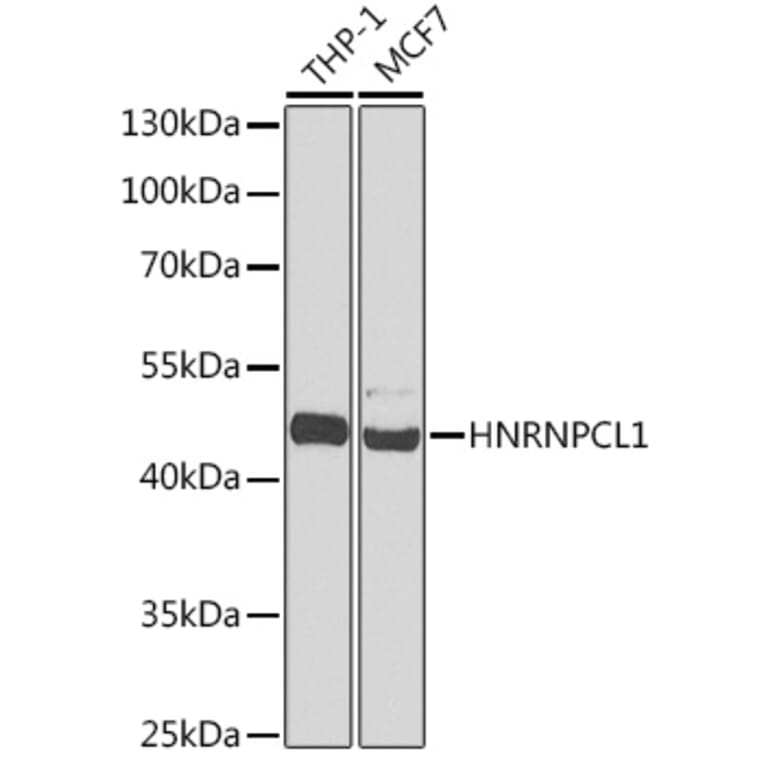Western Blot - Anti-HNRNPCL1 Antibody (A91580) - Antibodies.com