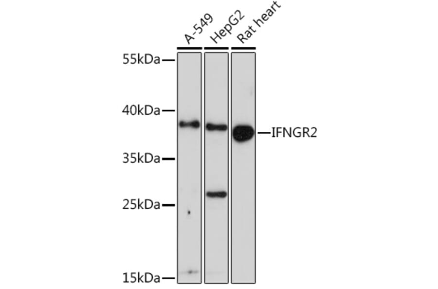 Western Blot - Anti-IFN gamma Receptor beta/AF-1 Antibody (A91581) - Antibodies.com