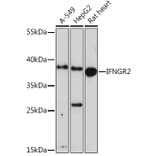 Western Blot - Anti-IFN gamma Receptor beta/AF-1 Antibody (A91581) - Antibodies.com