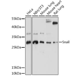 Western Blot - Anti-SNAIL Antibody (A91583) - Antibodies.com