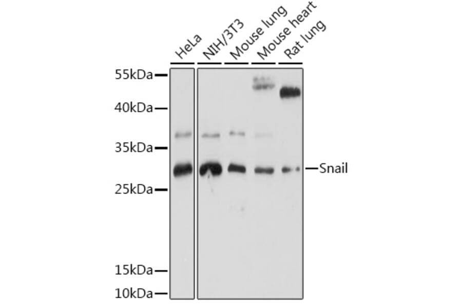 Western Blot - Anti-SNAIL Antibody (A91583) - Antibodies.com