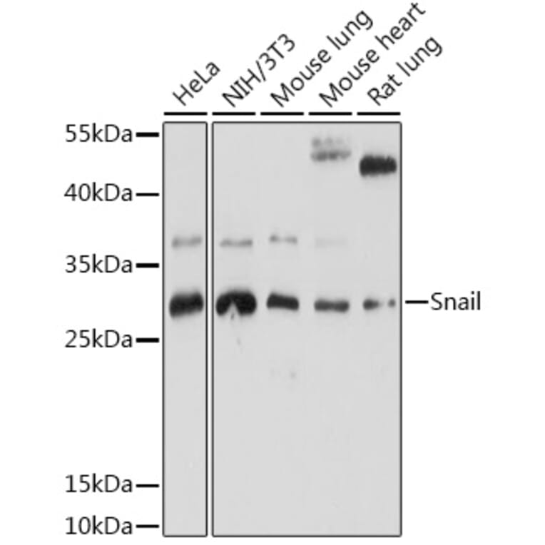 Western Blot - Anti-SNAIL Antibody (A91583) - Antibodies.com