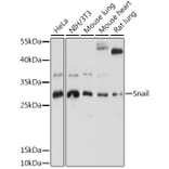 Western Blot - Anti-SNAIL Antibody (A91583) - Antibodies.com