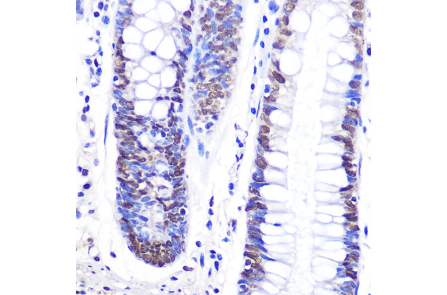 Immunohistochemistry - Anti-SNAIL Antibody (A91583) - Antibodies.com
