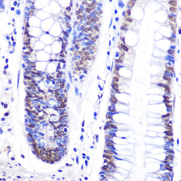 Immunohistochemistry - Anti-SNAIL Antibody (A91583) - Antibodies.com