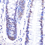 Immunohistochemistry - Anti-SNAIL Antibody (A91583) - Antibodies.com