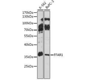 Western Blot - Anti-GPCR GPR40 Antibody (A91584) - Antibodies.com
