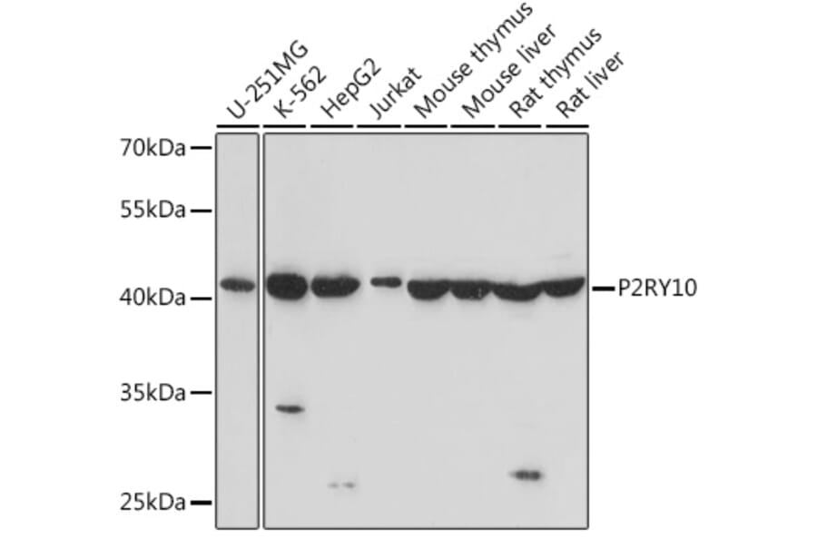 Western Blot - Anti-P2Y10 Antibody (A91586) - Antibodies.com