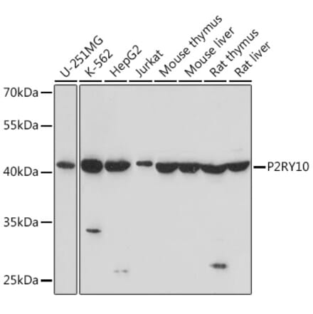 Western Blot - Anti-P2Y10 Antibody (A91586) - Antibodies.com
