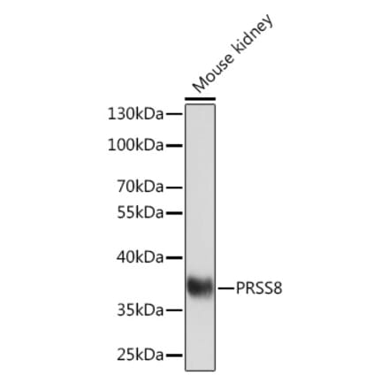Western Blot - Anti-PRSS8 Antibody (A91587) - Antibodies.com
