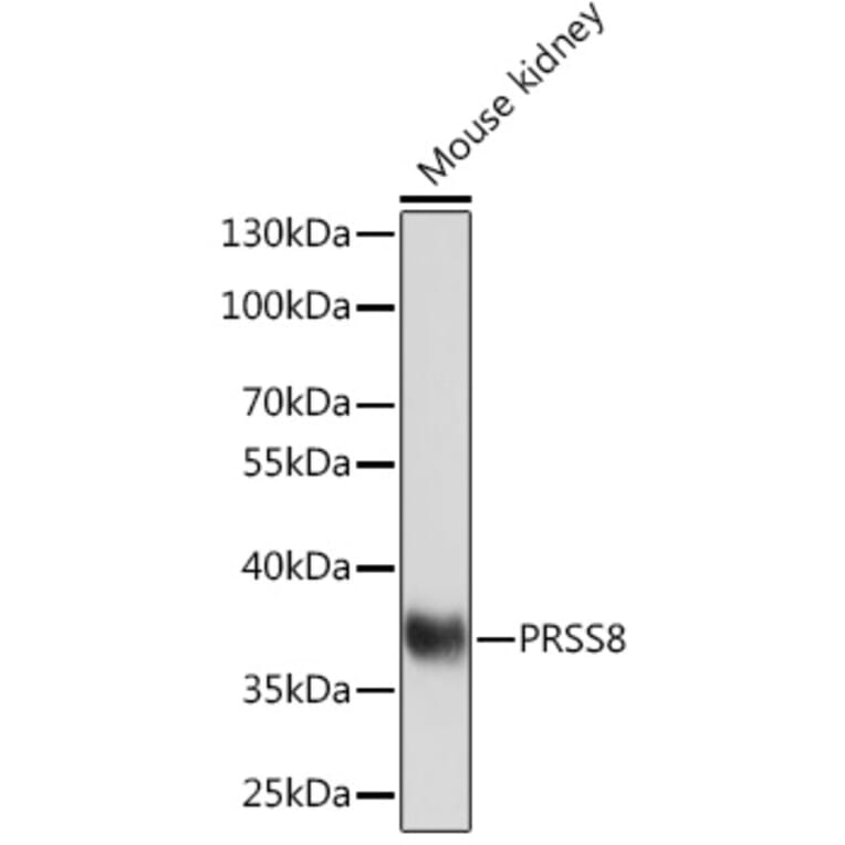Western Blot - Anti-PRSS8 Antibody (A91587) - Antibodies.com