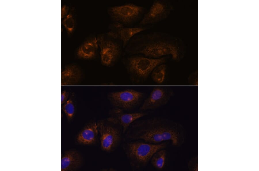 Immunofluorescence - Anti-PRSS8 Antibody (A91587) - Antibodies.com