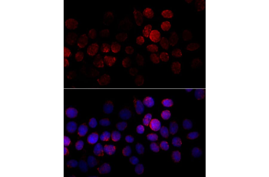 Immunofluorescence - Anti-CYP2J2 Antibody (A15045) - Antibodies.com