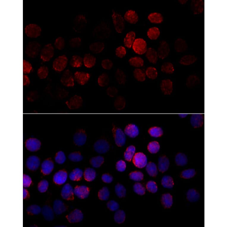 Immunofluorescence - Anti-CYP2J2 Antibody (A15045) - Antibodies.com