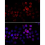 Immunofluorescence - Anti-CYP2J2 Antibody (A15045) - Antibodies.com