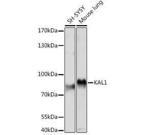 Western Blot - Anti-KAL1 Antibody (A91591) - Antibodies.com