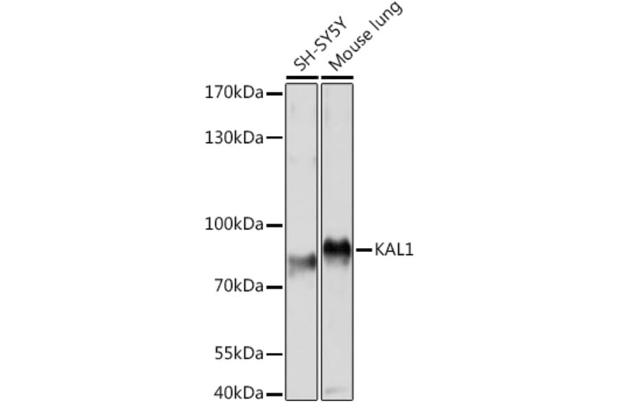 Western Blot - Anti-KAL1 Antibody (A91591) - Antibodies.com