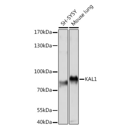 Western Blot - Anti-KAL1 Antibody (A91591) - Antibodies.com