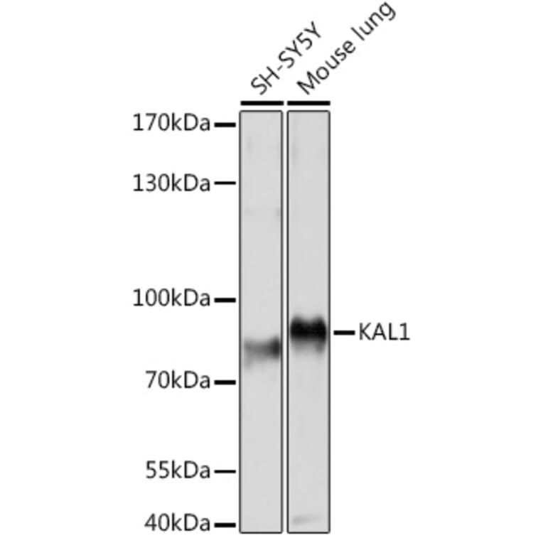 Western Blot - Anti-KAL1 Antibody (A91591) - Antibodies.com