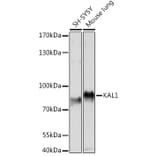 Western Blot - Anti-KAL1 Antibody (A91591) - Antibodies.com