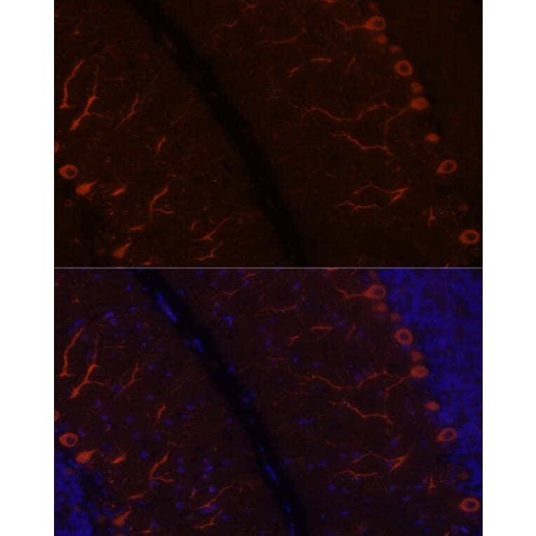 Immunofluorescence - Anti-KAL1 Antibody (A91591) - Antibodies.com