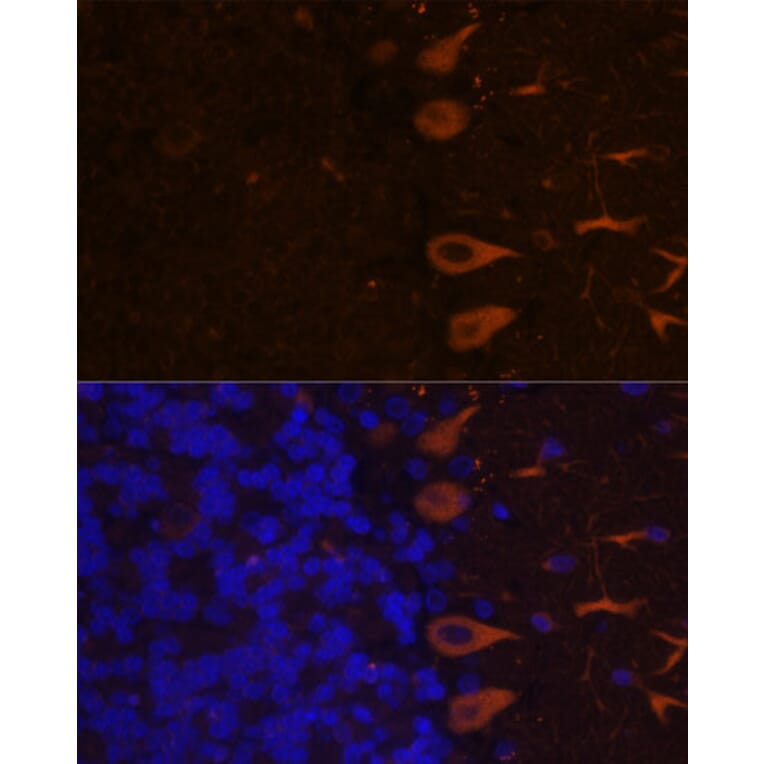 Immunofluorescence - Anti-KAL1 Antibody (A91591) - Antibodies.com