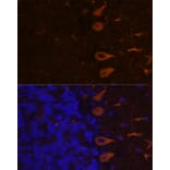 Immunofluorescence - Anti-KAL1 Antibody (A91591) - Antibodies.com