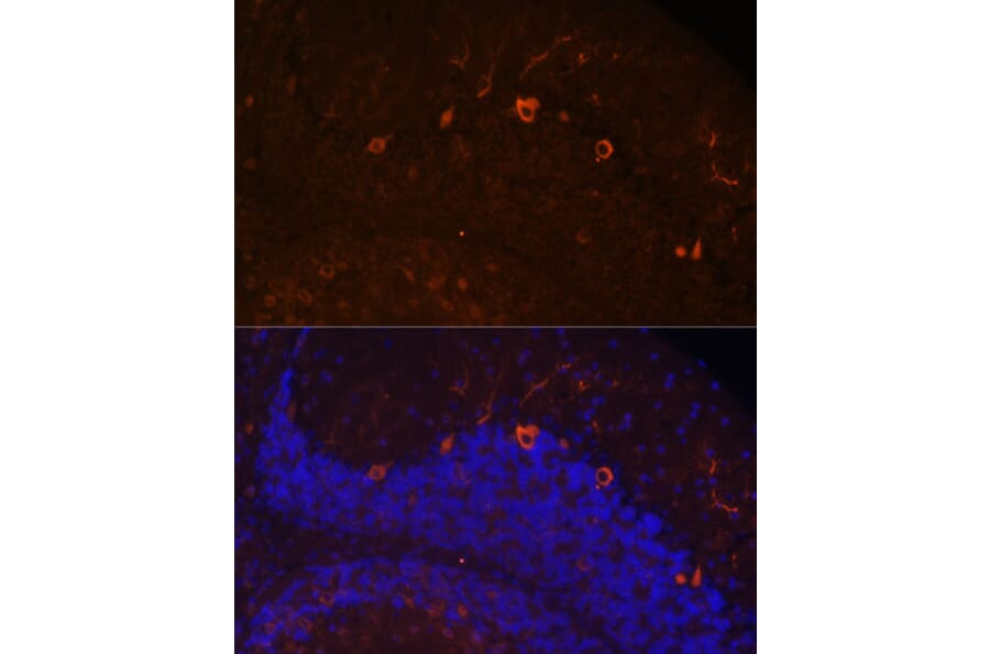 Immunofluorescence - Anti-KAL1 Antibody (A91591) - Antibodies.com