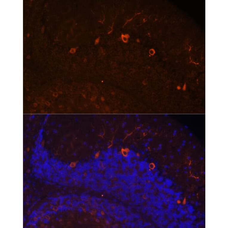 Immunofluorescence - Anti-KAL1 Antibody (A91591) - Antibodies.com