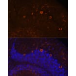 Immunofluorescence - Anti-KAL1 Antibody (A91591) - Antibodies.com