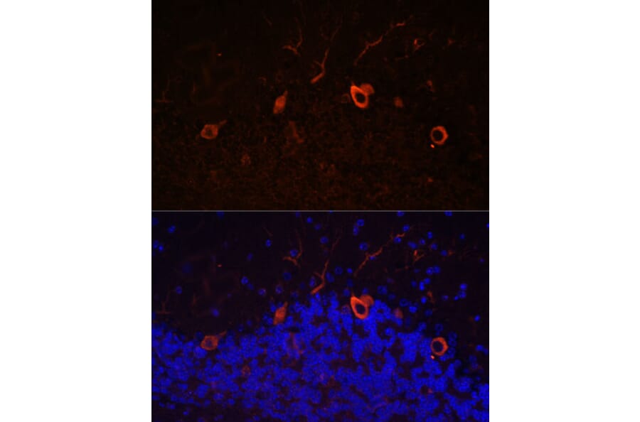 Immunofluorescence - Anti-KAL1 Antibody (A91591) - Antibodies.com