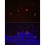 Immunofluorescence - Anti-KAL1 Antibody (A91591) - Antibodies.com