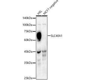 Western Blot - Anti-SLC40A1 Antibody (A91593) - Antibodies.com