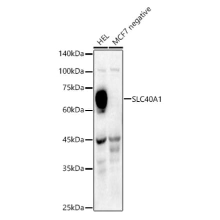 Western Blot - Anti-SLC40A1 Antibody (A91593) - Antibodies.com