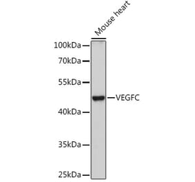 Western Blot - Anti-VEGFC Antibody (A91595) - Antibodies.com