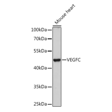 Western Blot - Anti-VEGFC Antibody (A91595) - Antibodies.com