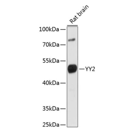 Western Blot - Anti-YY2 Antibody (A91596) - Antibodies.com