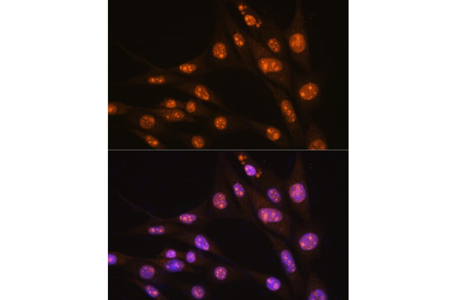 Immunofluorescence - Anti-YY2 Antibody (A91596) - Antibodies.com