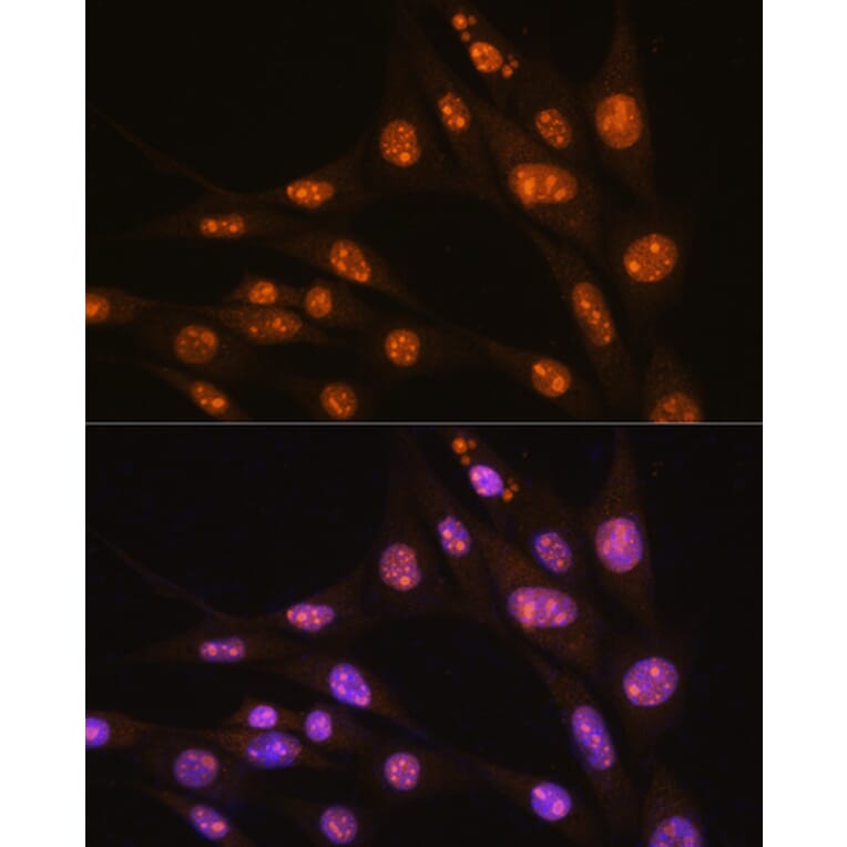 Immunofluorescence - Anti-YY2 Antibody (A91596) - Antibodies.com