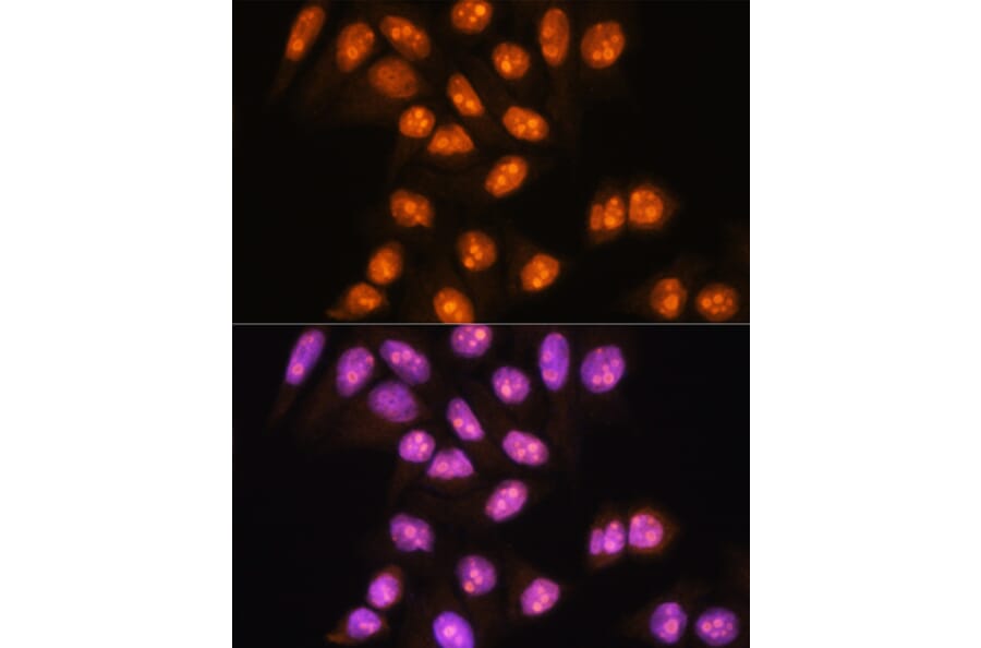 Immunofluorescence - Anti-YY2 Antibody (A91596) - Antibodies.com