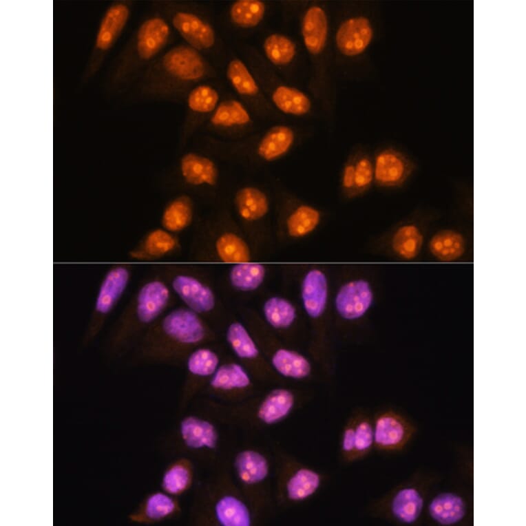 Immunofluorescence - Anti-YY2 Antibody (A91596) - Antibodies.com