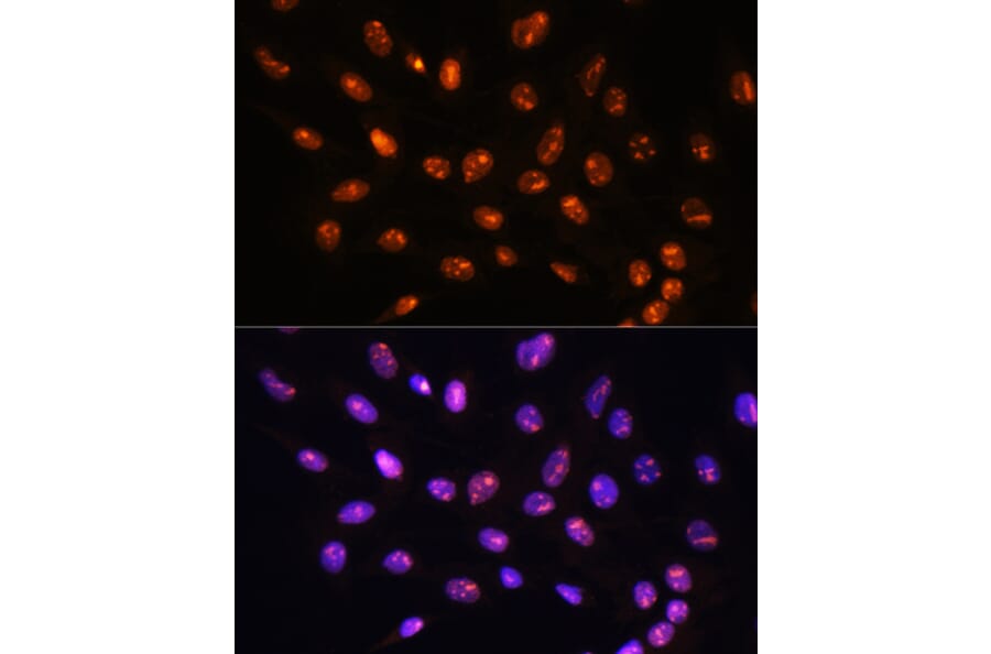 Immunofluorescence - Anti-YY2 Antibody (A91596) - Antibodies.com