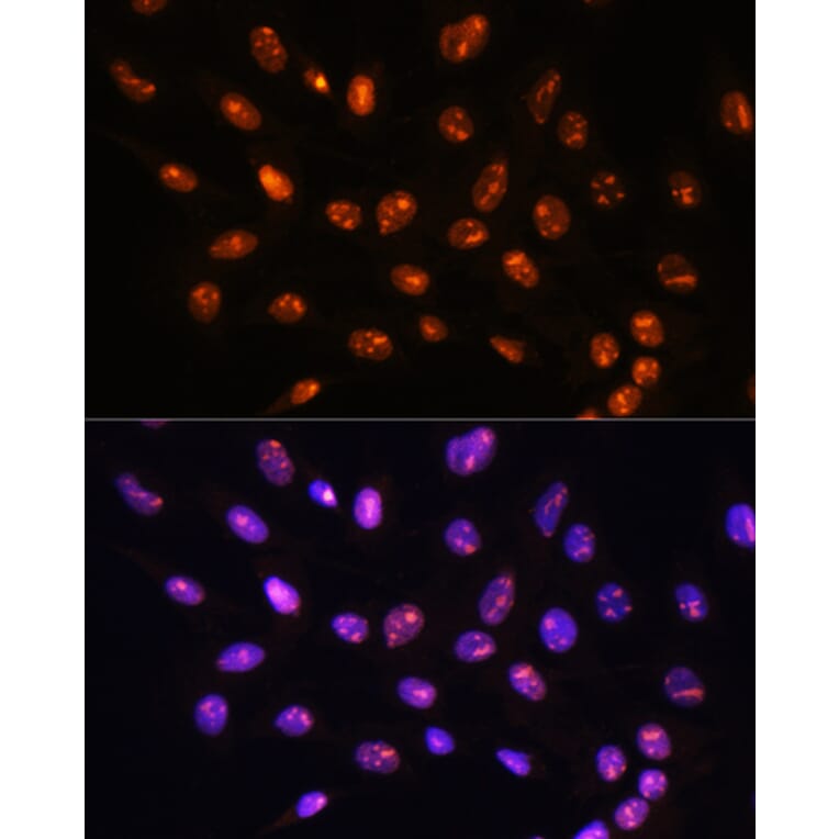 Immunofluorescence - Anti-YY2 Antibody (A91596) - Antibodies.com