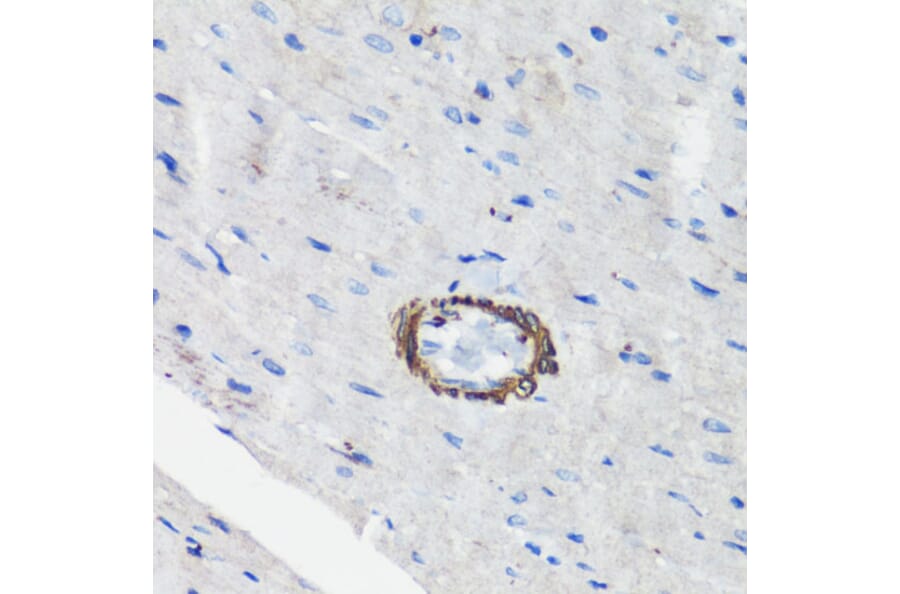 Immunohistochemistry - Anti-Filamin A Antibody (A91597) - Antibodies.com