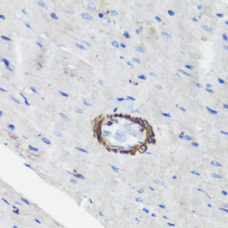 Immunohistochemistry - Anti-Filamin A Antibody (A91597) - Antibodies.com