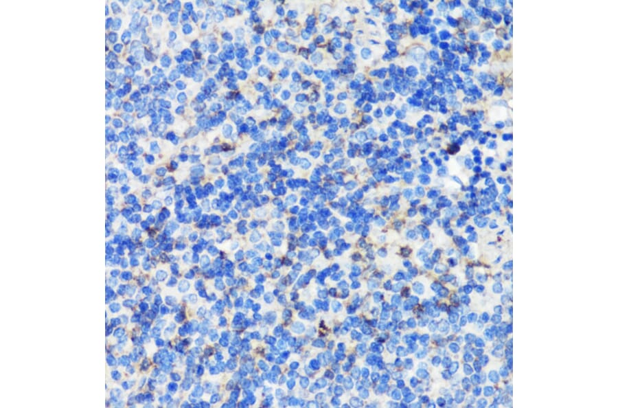 Immunohistochemistry - Anti-Filamin A Antibody (A91597) - Antibodies.com